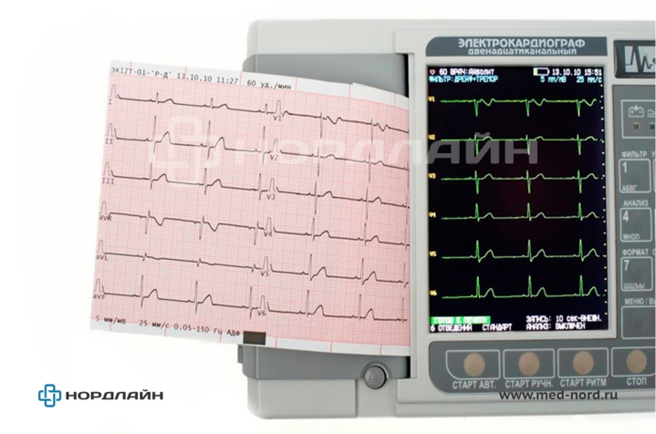 Электрокардиограф ЭК12Т-01-"Р-Д" с экраном 141мм